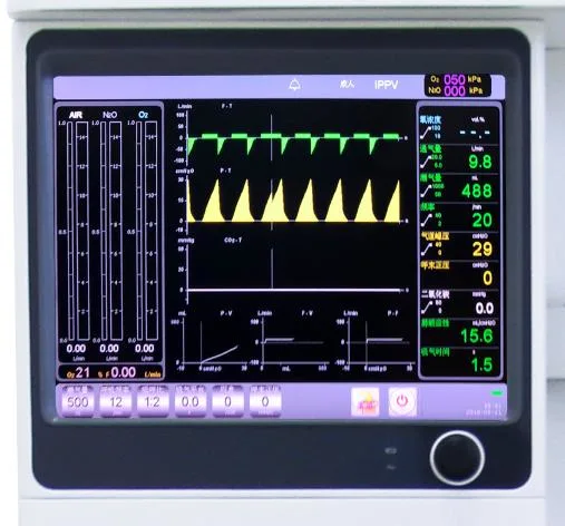 S6600 Etco2 AG Module Electronic Flowmeter Sevoflurane Vaporizer Anesthesia Anesthetic Anaesthesia Machine Anesthesiologist Equipment